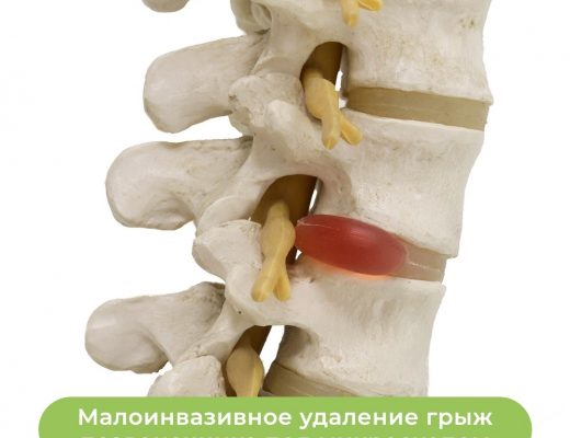 Малоинвазивная хирургия одного дня. Забыть о боли!