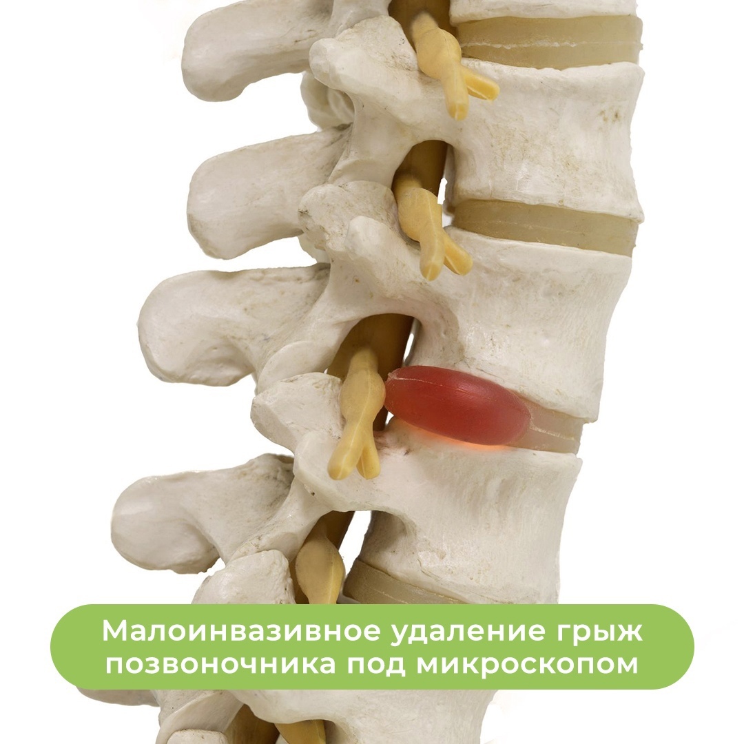 Малоинвазивная хирургия одного дня. Забыть о боли!