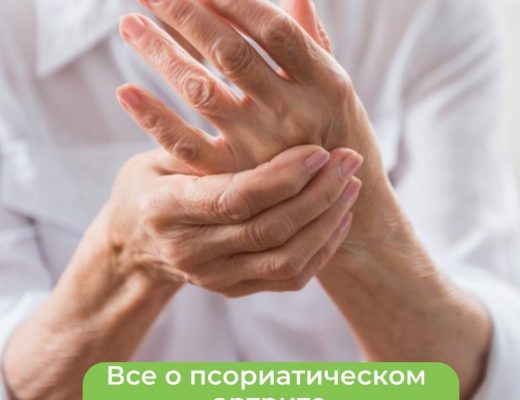 Всё о псориатическом артрите